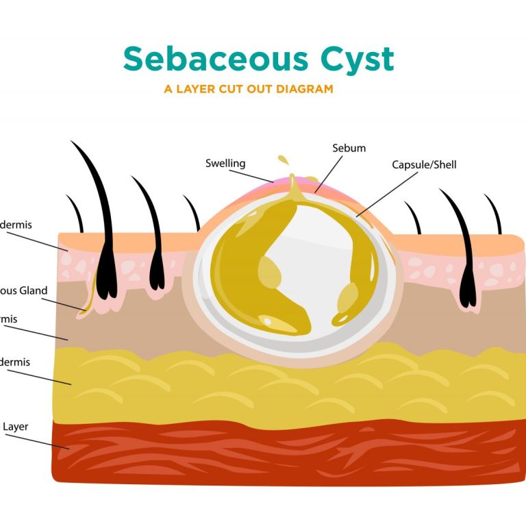 484018875_122235008126031802_521532363938476096_n